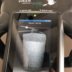 Viken hordozható röntgen, backskatter