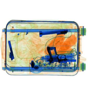 Komputertomográfiás technológiával készített röntgenfelvétel